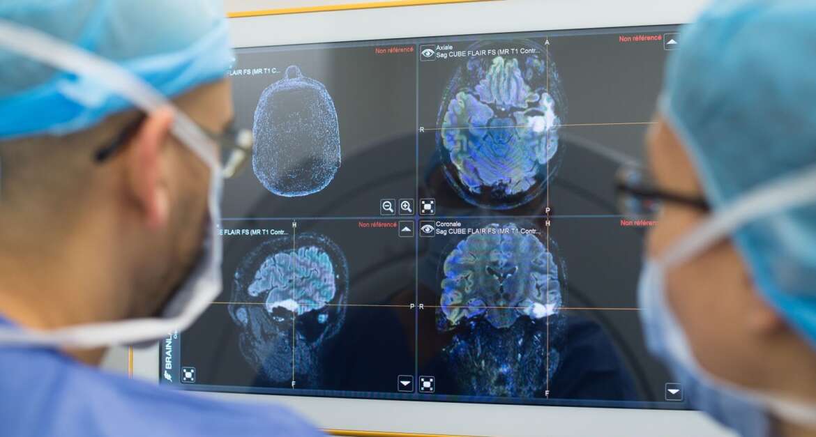 Know more about Brain Surgery