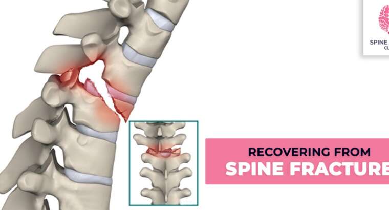 Recovering from Spine Fracture