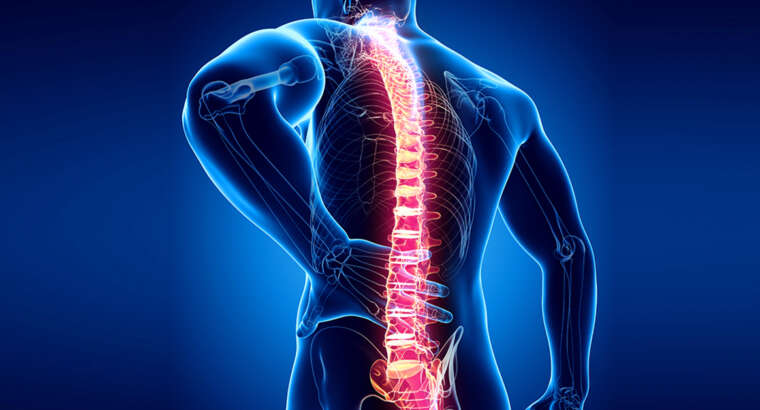 Spinal Stenosis: Causes, Symptoms and Treatment Approaches